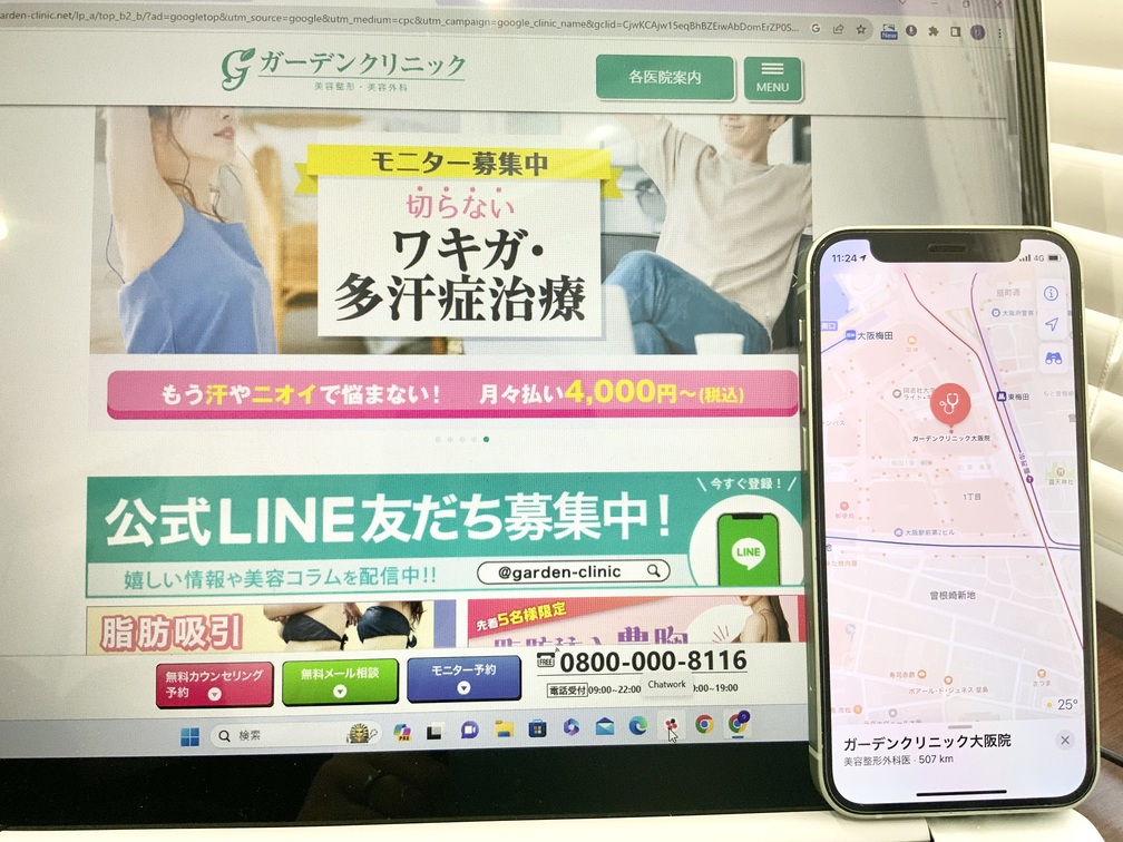 ガーデンクリニック発毛医療外