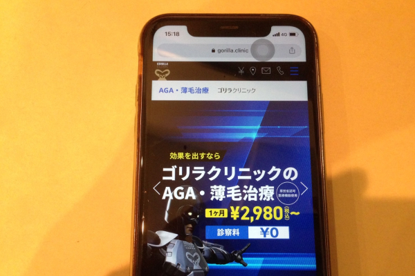 ゴリラクリニックAGA