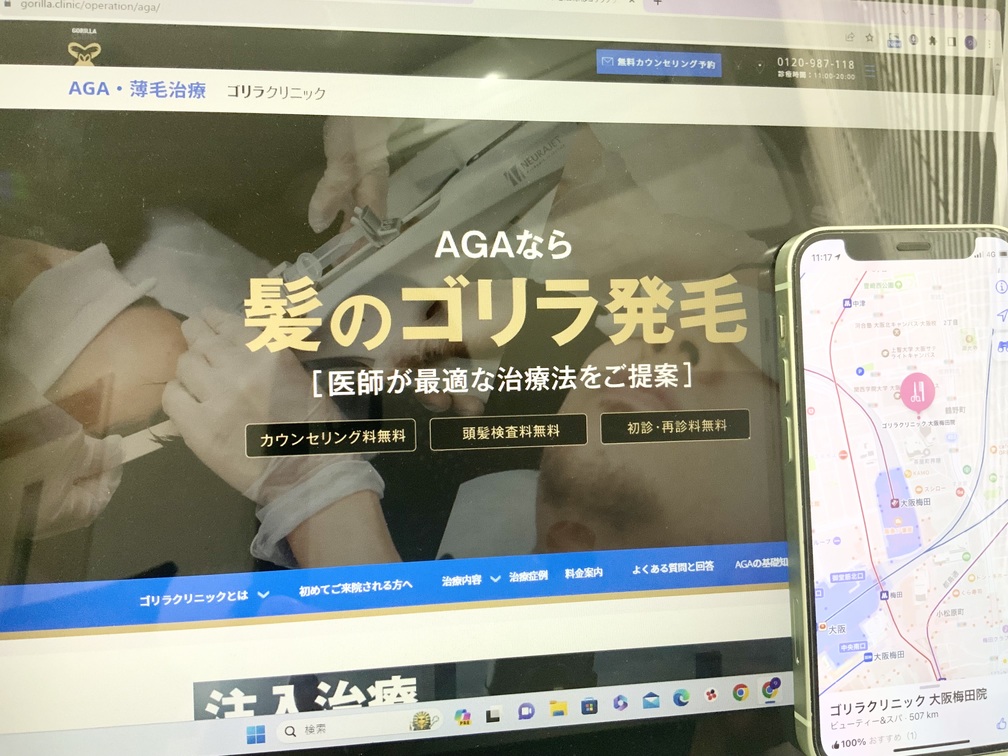 ゴリラクリニック大阪